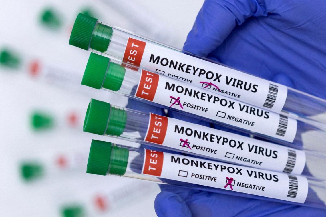 monkeypox virus