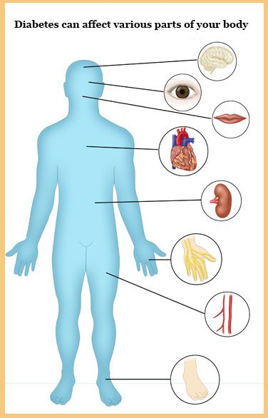 how to prevent diabetes
