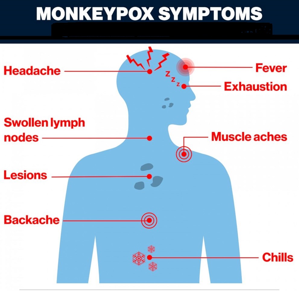 Monkeypox_Symptoms