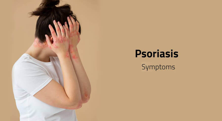 Psoriasis Causes