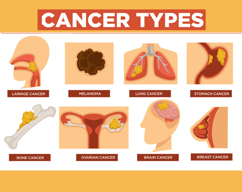 cancer types